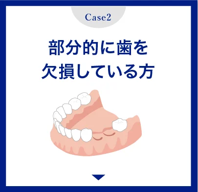 部分的に歯を欠損している方