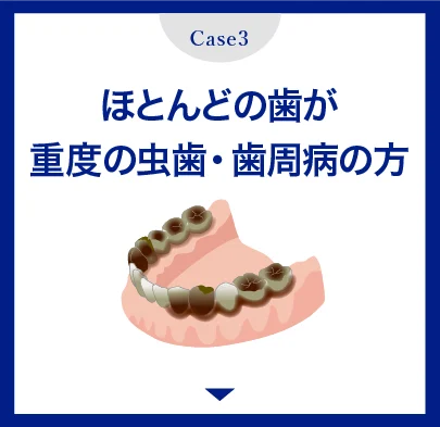 ほとんどの歯が重度の虫歯・歯周病の方