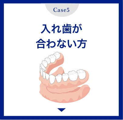 入れ歯が合わない方